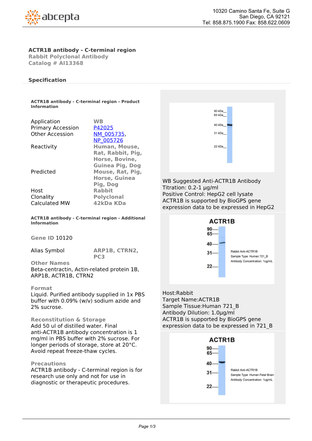 ACTR1B Antibody - C-Terminal Region Rabbit Polyclonal Antibody Catalog # AI13368