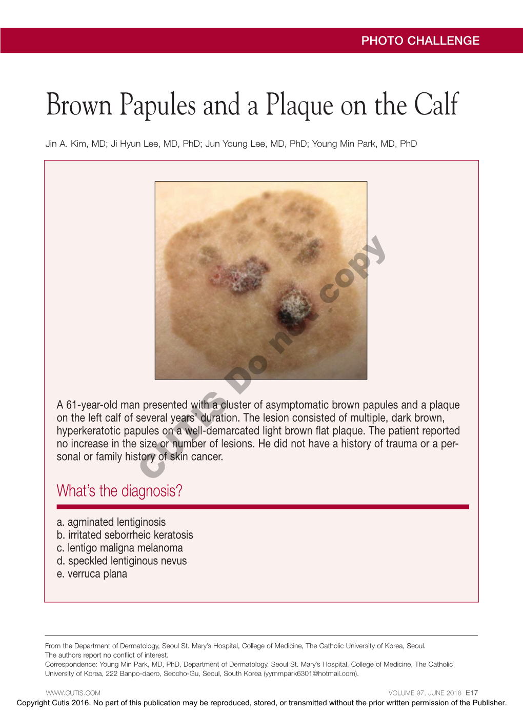 Brown Papules and a Plaque on the Calf