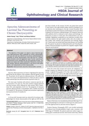 Apocrine Adenocarcinoma of Lacrimal Sac Presenting As Chronic Dacryocystitis