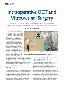 Intraoperative OCT and Vitreoretinal Surgery