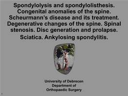 Spondylolysis and Spondylolisthesis. Congenital Anomalies of the Spine
