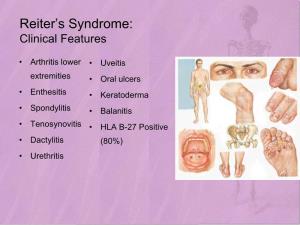 Reiter's Syndrome