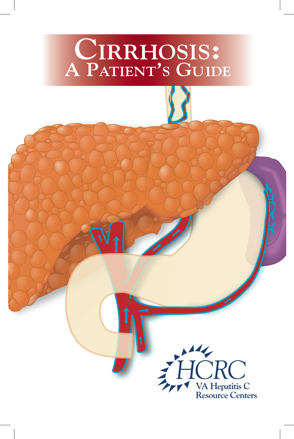 Cirrhosis: a Patient’S Guide the Full Text of This Document Can Be Found and Down- Loaded At