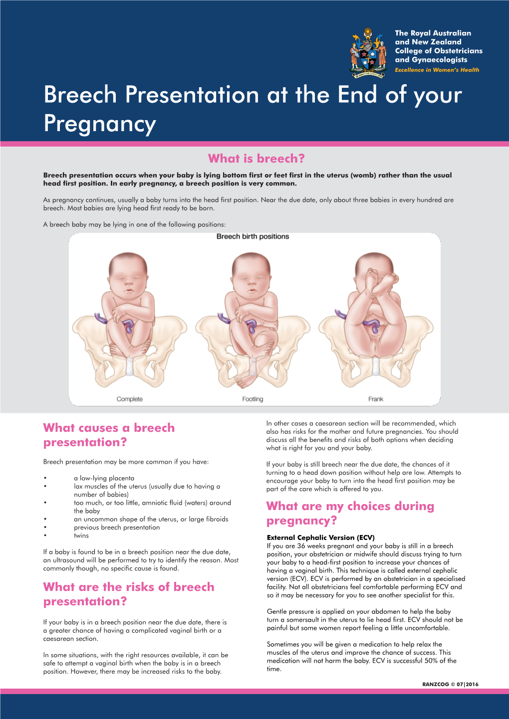 Breech Presentation at the End of Your Pregnancy