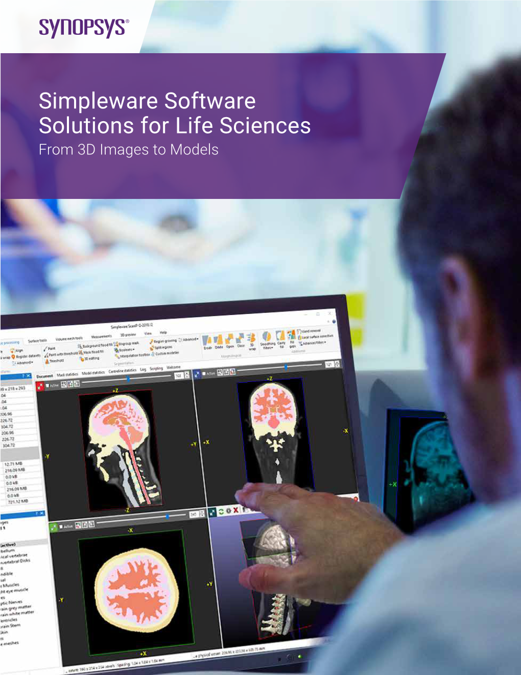 Simpleware Software Solutions for Life Sciences from 3D Images to Models Applications in Life Sciences