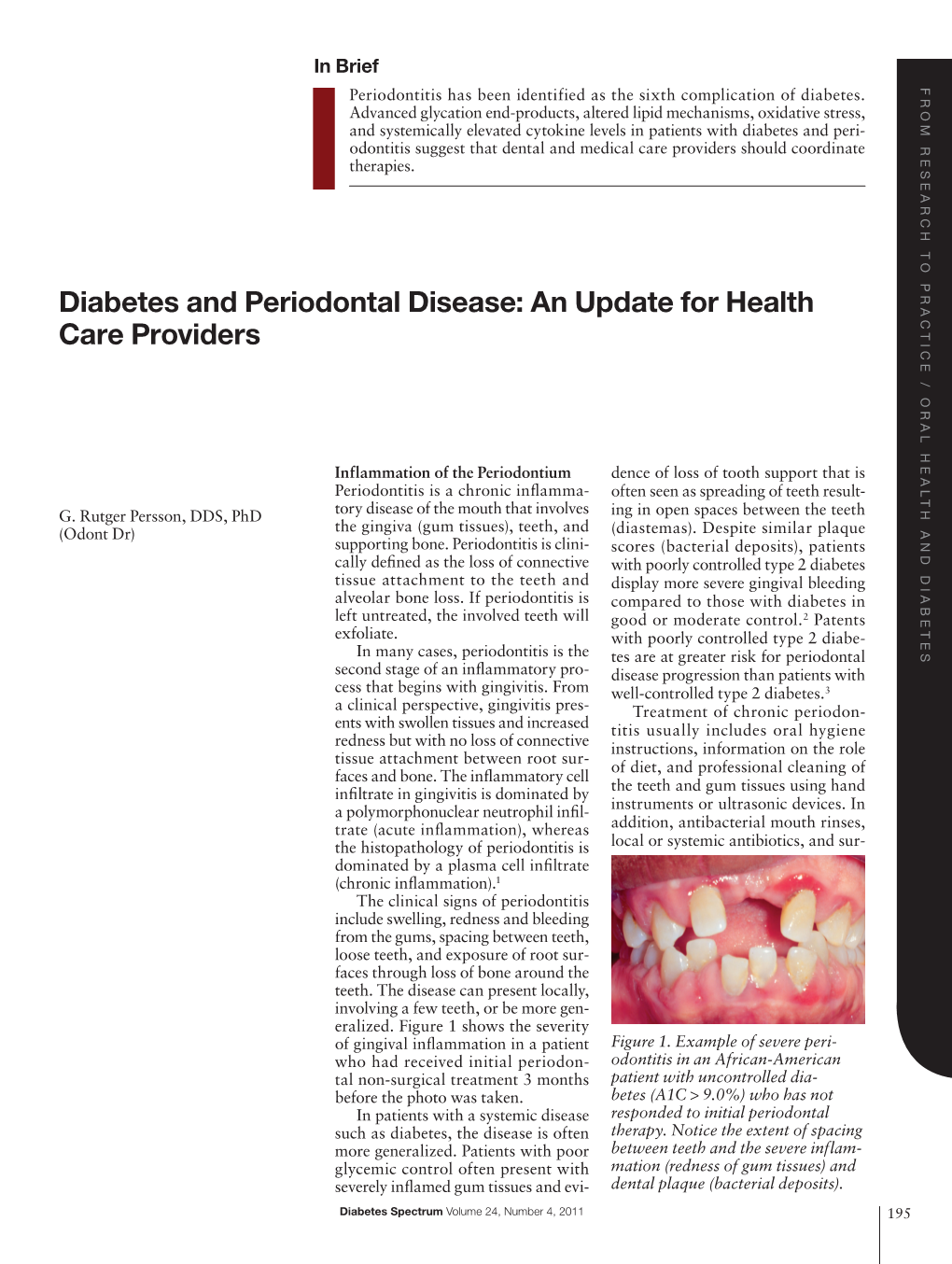 Diabetes and Periodontal Disease: an Update for Health Care Providers