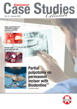 Partial Pulpotomy on Permanent Incisor with Biodentine™ Dr Guzman De Hoyos Editorial
