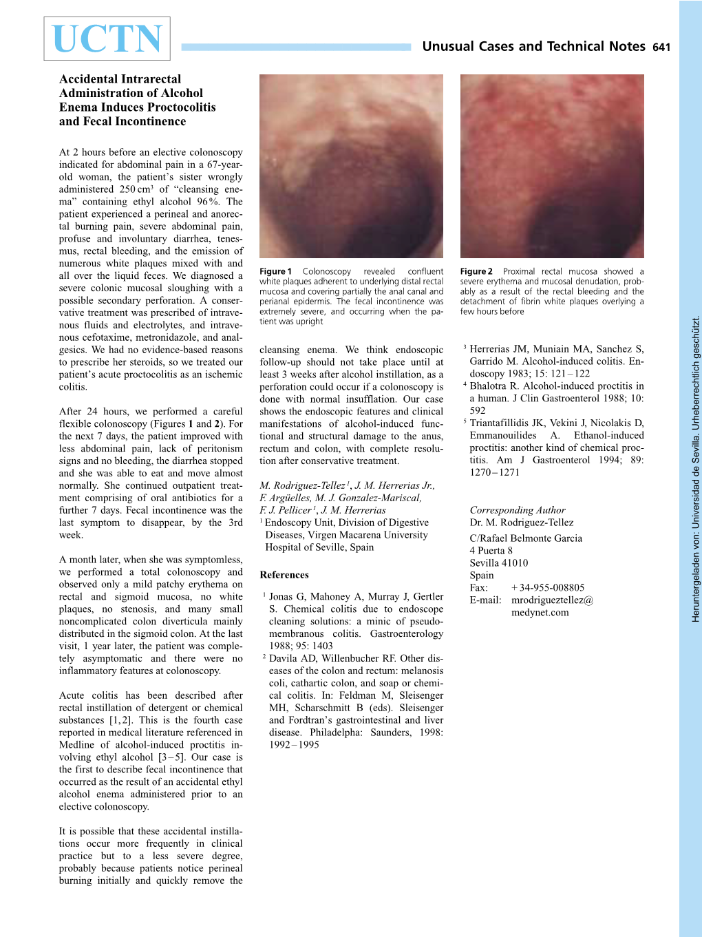 Accidental Intrarectal Administration of Alcohol Enema Induces Proctocolitis and Fecal Incontinence