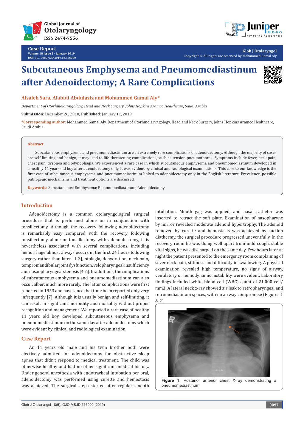 Subcutaneous Emphysema and Pneumomediastinum After Adenoidectomy; a Rare Complications