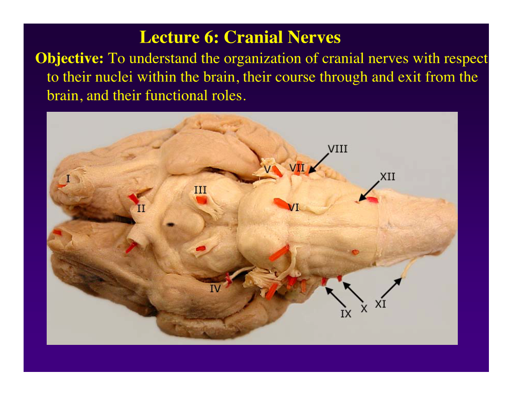 Lecture 6: Cranial Nerves