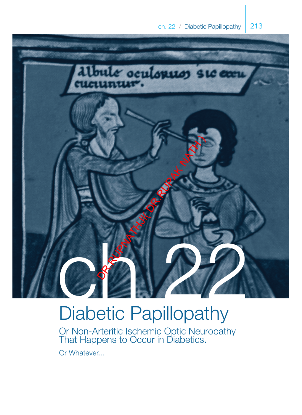 Diabetic Papillopathy 213