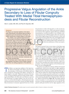 Progressive Valgus Angulation of the Ankle Secondary to Loss of Fibular Congruity Treated with Medial Tibial Hemiepiphysio- Desis and Fibular Reconstruction