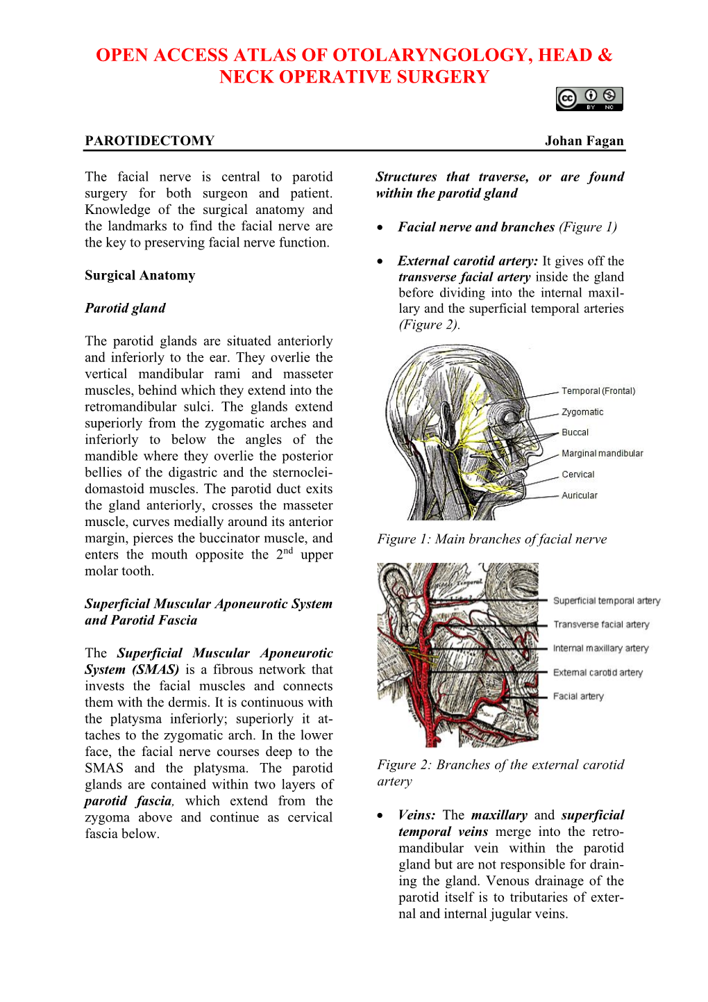 PAROTIDECTOMY Johan Fagan