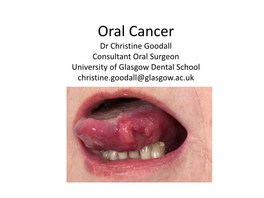 Oral Cancer Dr Christine Goodall Consultant Oral Surgeon University of Glasgow Dental School Christine.Goodall@Glasgow.Ac.Uk Locations