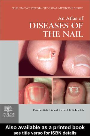 Atlas of DISEASES of the NAIL