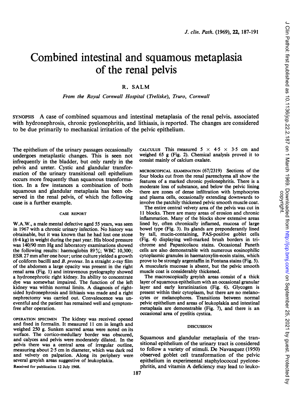 Combined Intestinal and Squamous Metaplasia of the Renal Pelvis