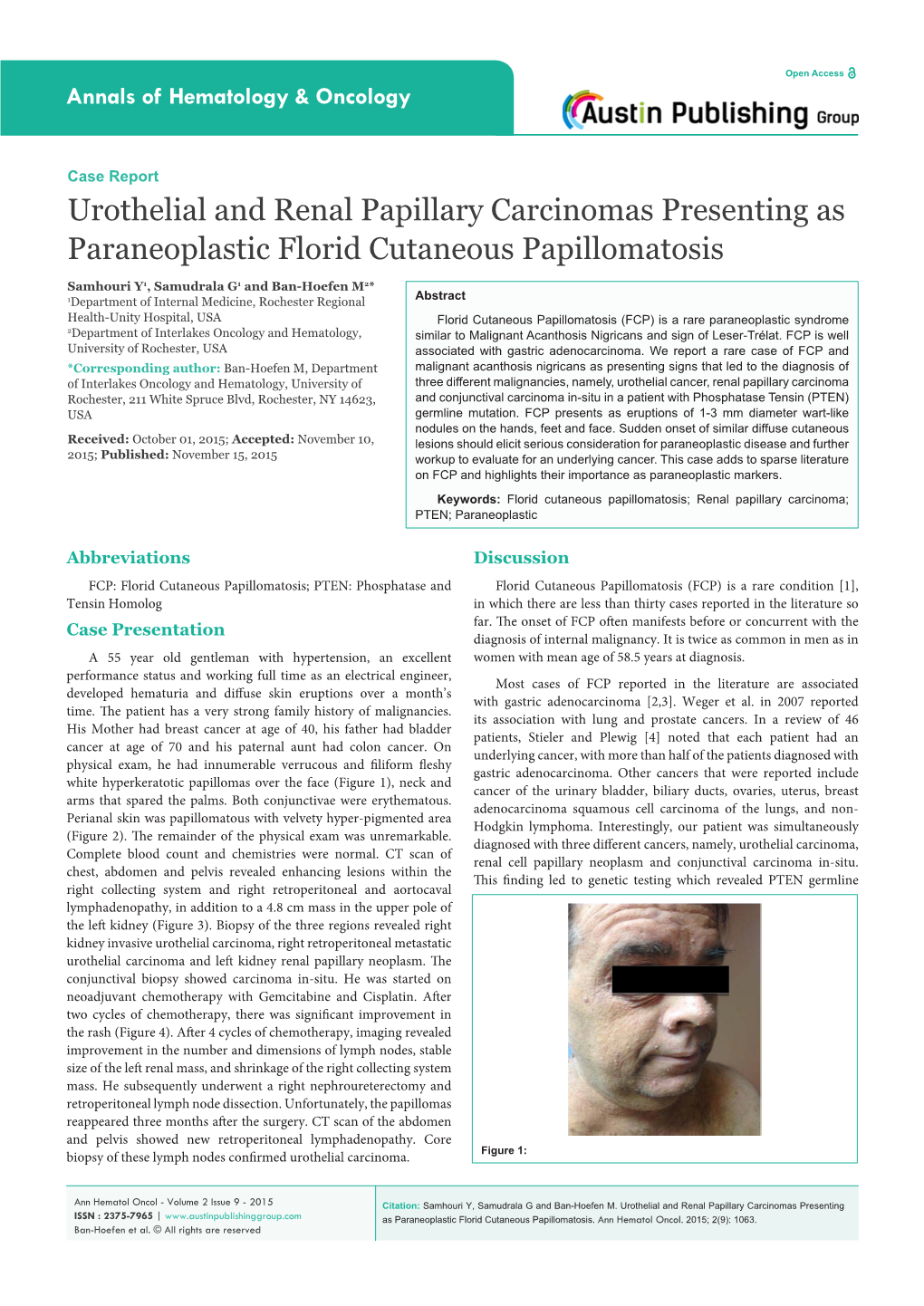 Urothelial And Renal Papillary Carcinomas Presenting As Paraneoplastic Florid Cutaneous