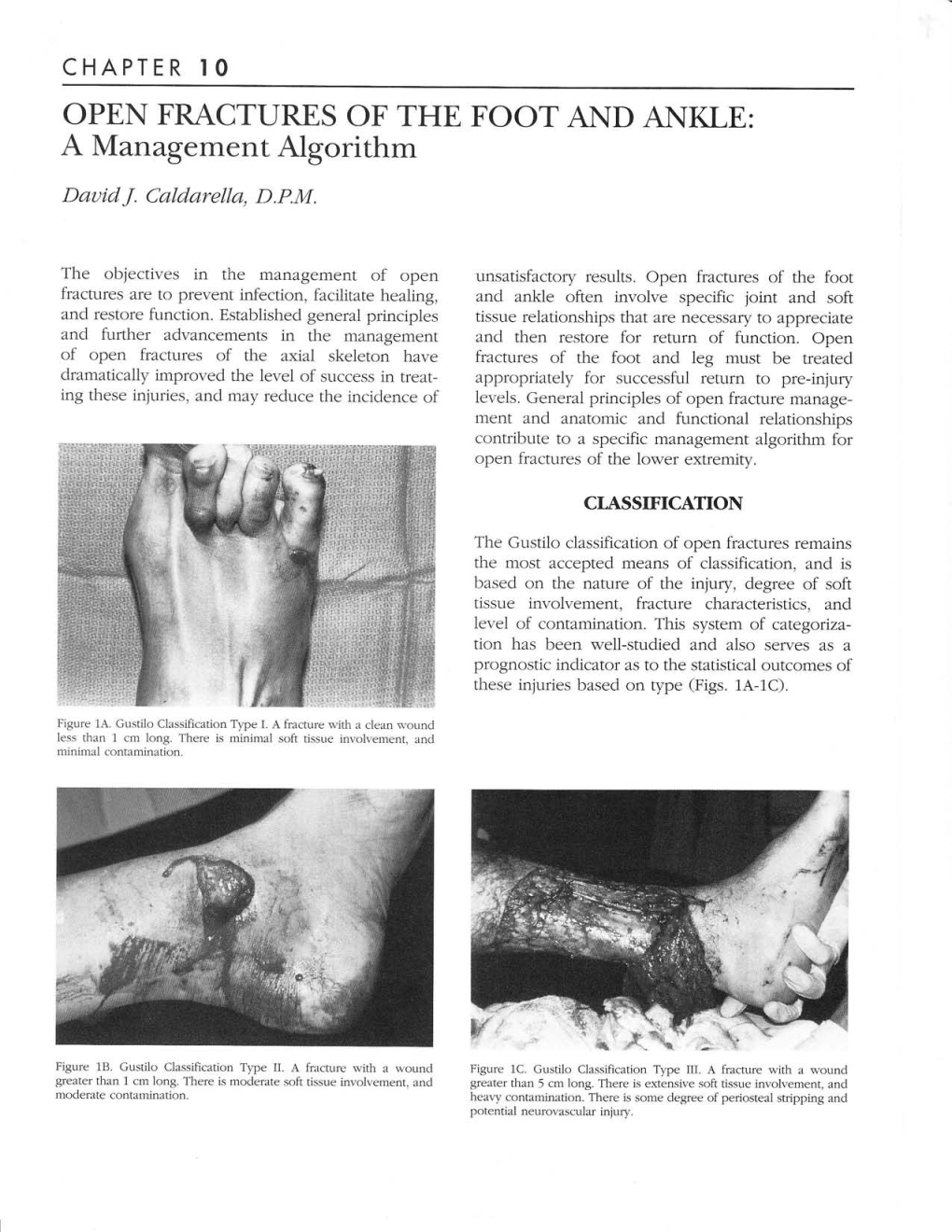 OPEN FRACTURES of the FOOT and ANKLE: a Management Algorithm