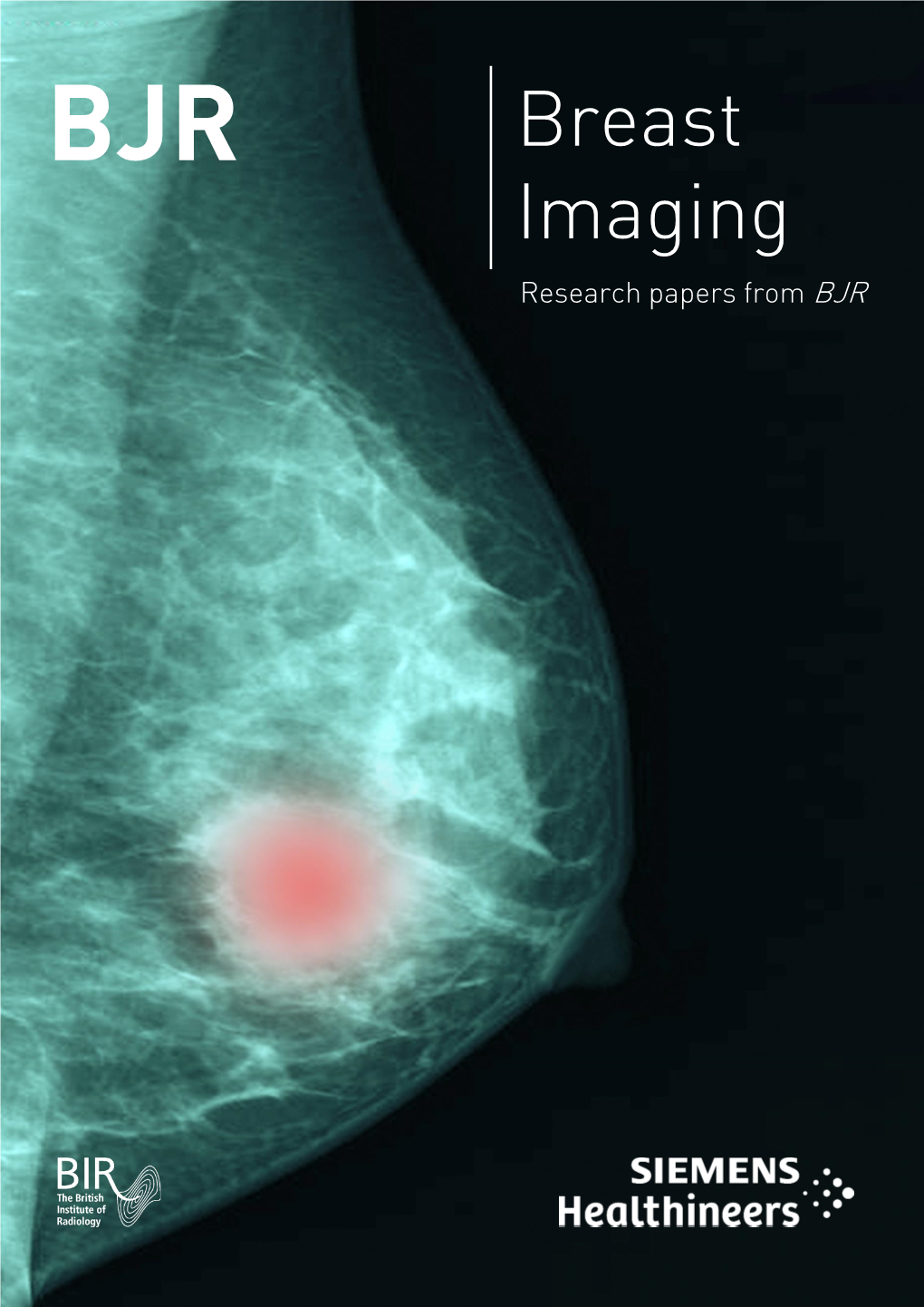 Breast Imaging Research Papers from BJR MAMMOMAT Revelation Inspect Integrated Specimen Scanner for Faster Biopsies