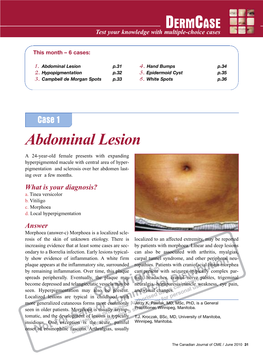 Abdominal Lesion P.31 4