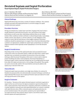 Deviated Septum and Septal Perforation Nasal Septum Repair/Septal Perforation Surgery