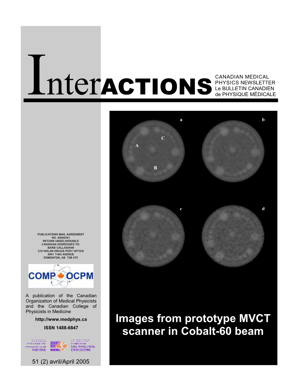 Images from Prototype MVCT Scanner in Cobalt-60 Beam