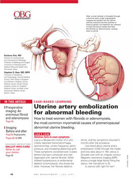 Uterine Artery Embolization for Abnormal Bleeding