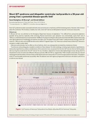 Short QT Syndrome and Idiopathic