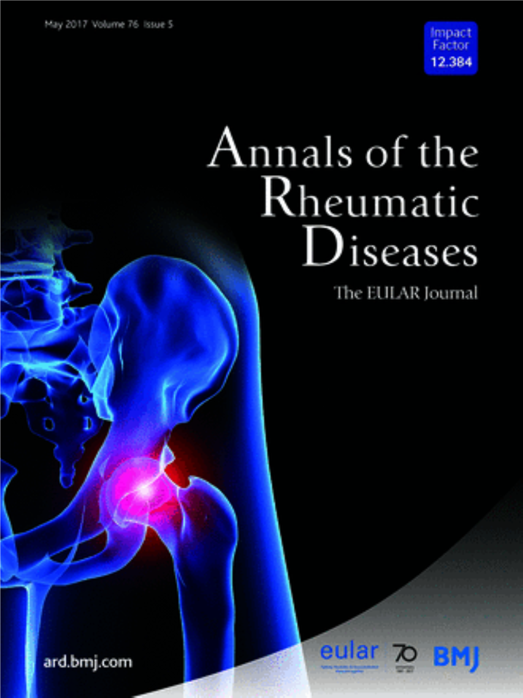 Annals of the Rheumatic Diseases 2017 5.Pdf