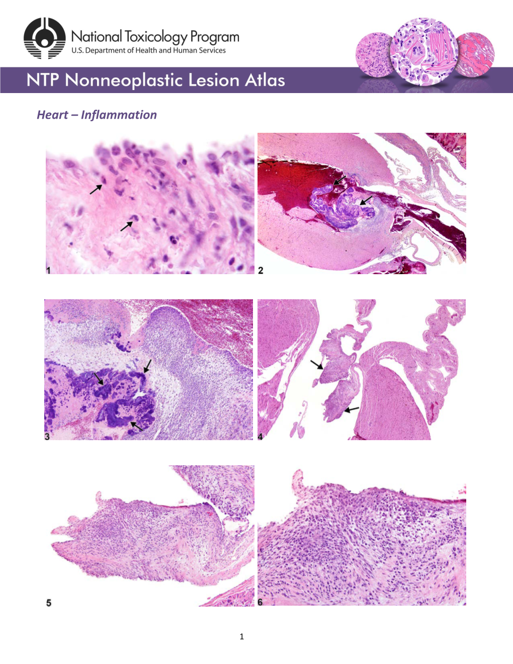 Heart – Inflammation