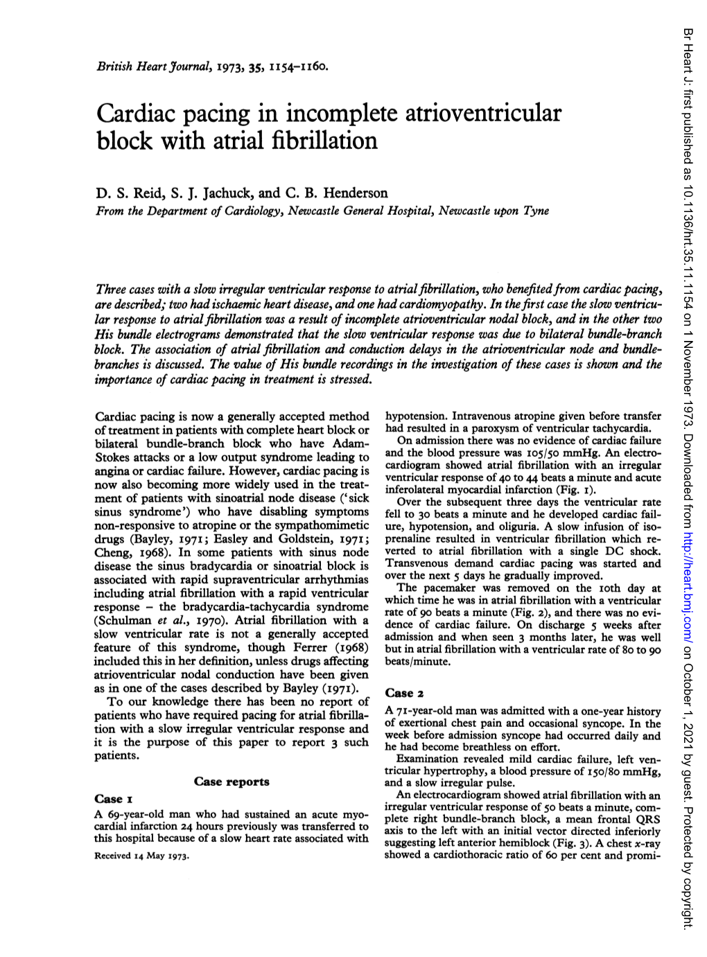 Cardiac Pacing in Incomplete Atrioventricular Block with Atrial Fibrillation