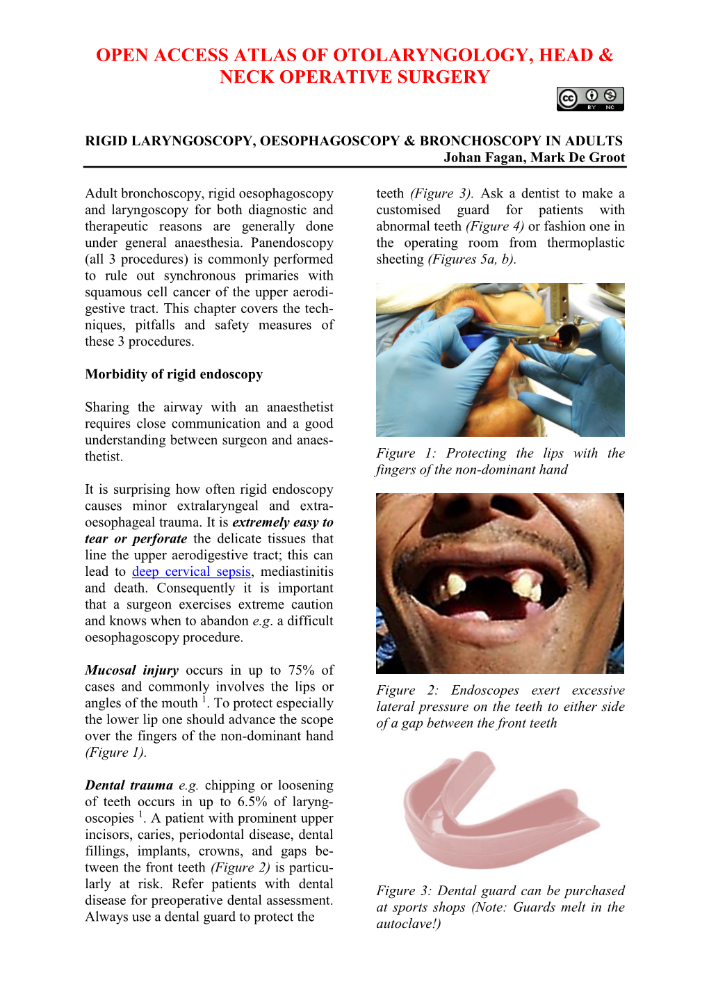 Rigid Laryngoscopy, Oesophagoscopy and Bronchoscopy in Adults