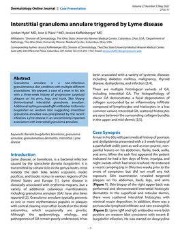 Interstitial Granuloma Annulare Triggered by Lyme Disease