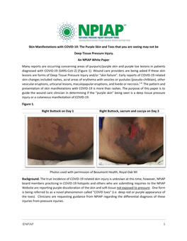 NPIAP 1 Skin Manifestations with COVID-19