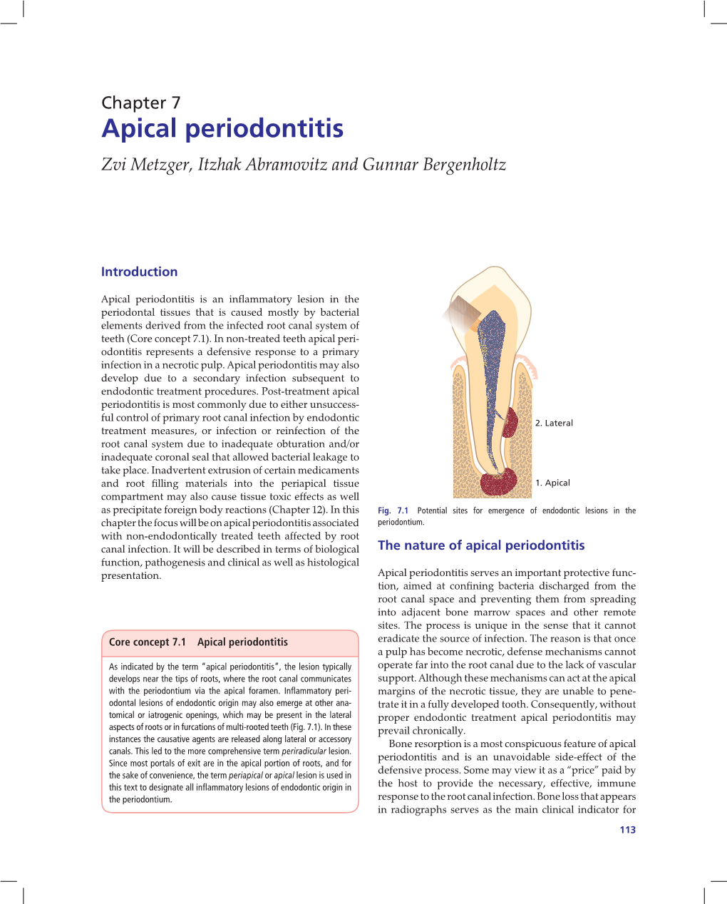 Apical Periodontitis Zvi Metzger, Itzhak Abramovitz and Gunnar Bergenholtz