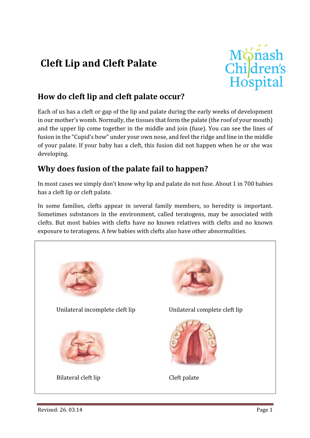 Cleft Lip and Cleft Palate