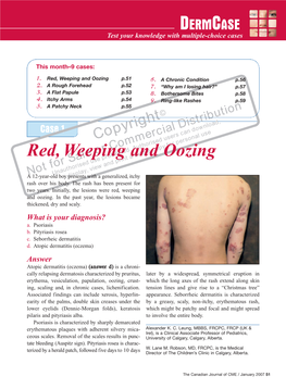 Red, Weeping and Oozing P.51 6