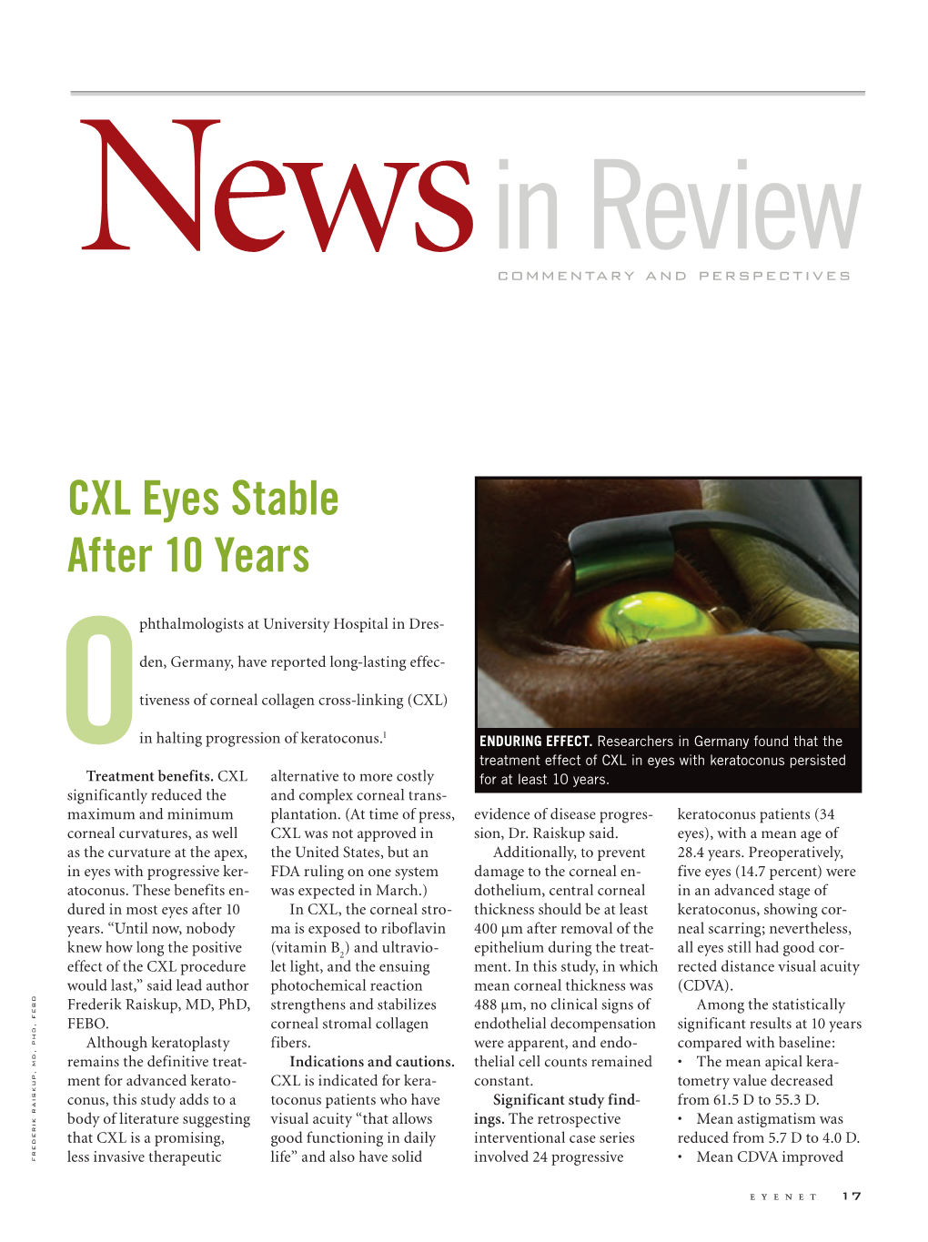 CXL Eyes Stable After 10 Years