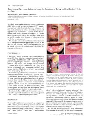 Hypertrophic (Verrucous) Cutaneous Lupus Erythematosus of the Lip and Oral Cavity: a Series of 4 Cases