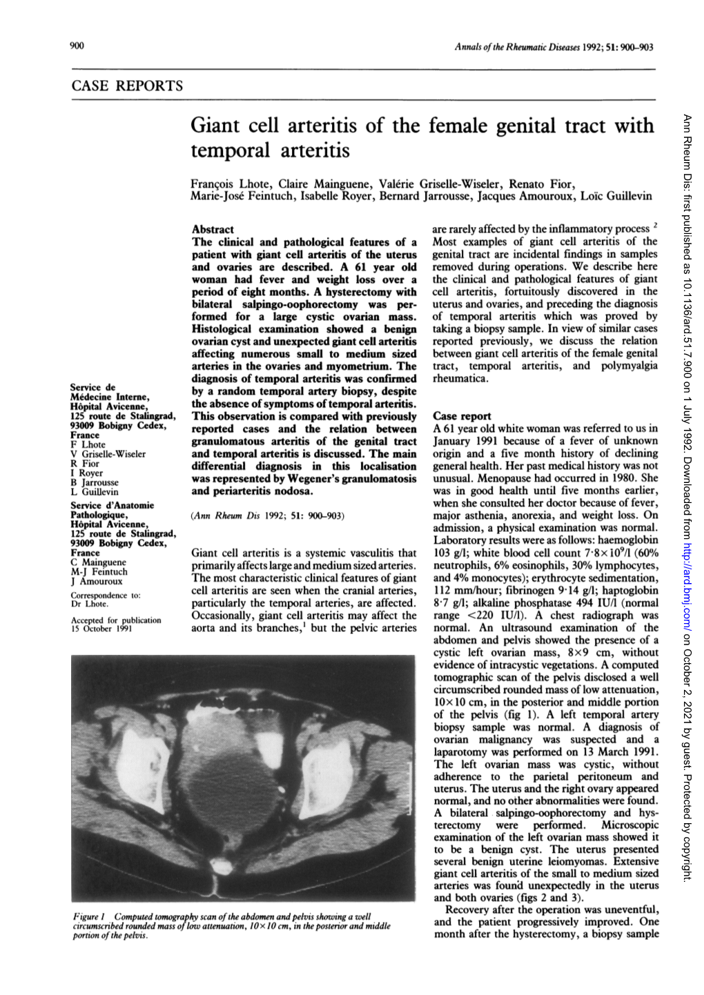 Giant Cell Arteritis of the Female Genital Tract With