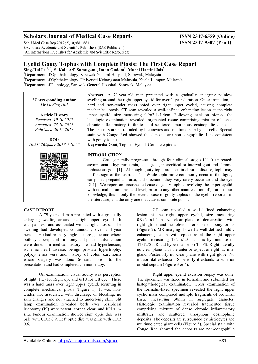 Scholars Journal of Medical Case Reports Eyelid Gouty Tophus with Complete Ptosis