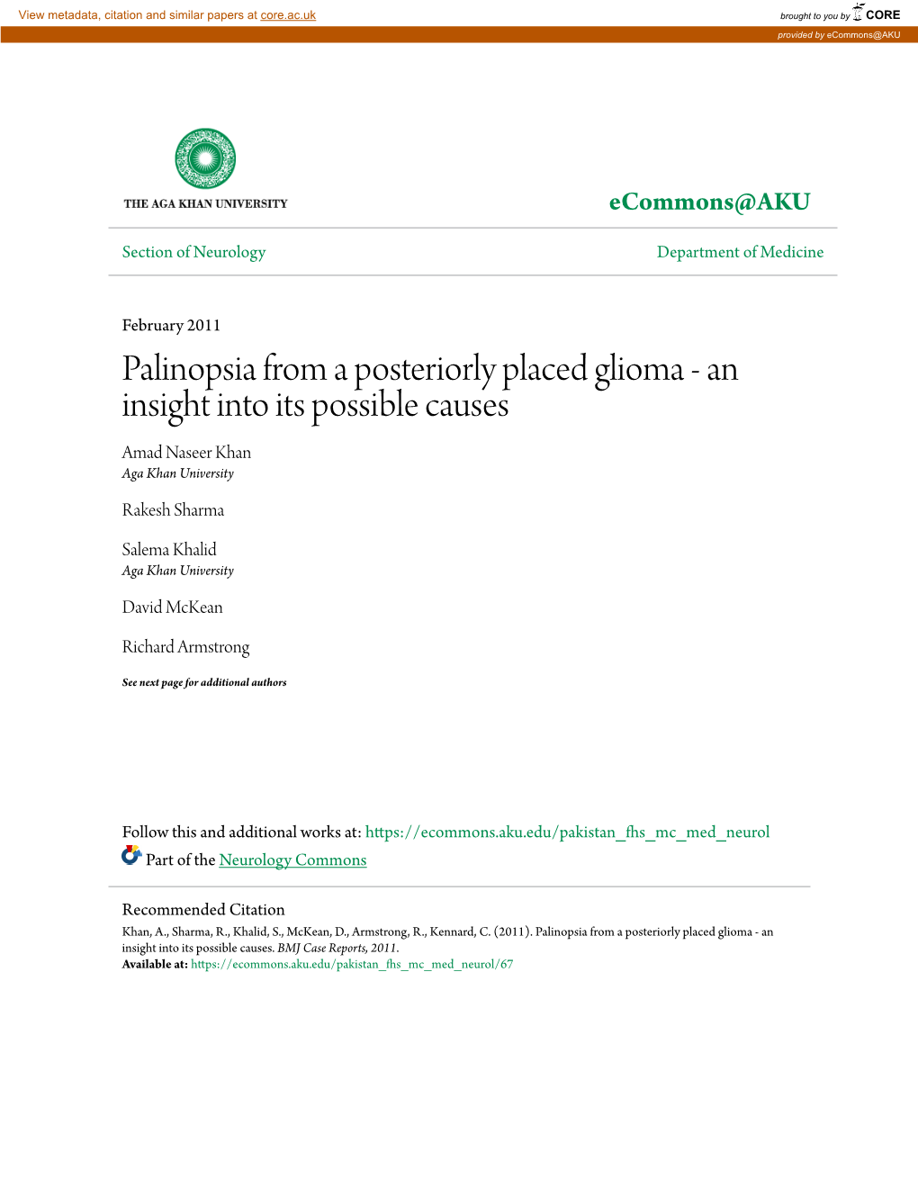 Palinopsia from a Posteriorly Placed Glioma - an Insight Into Its Possible Causes Amad Naseer Khan Aga Khan University