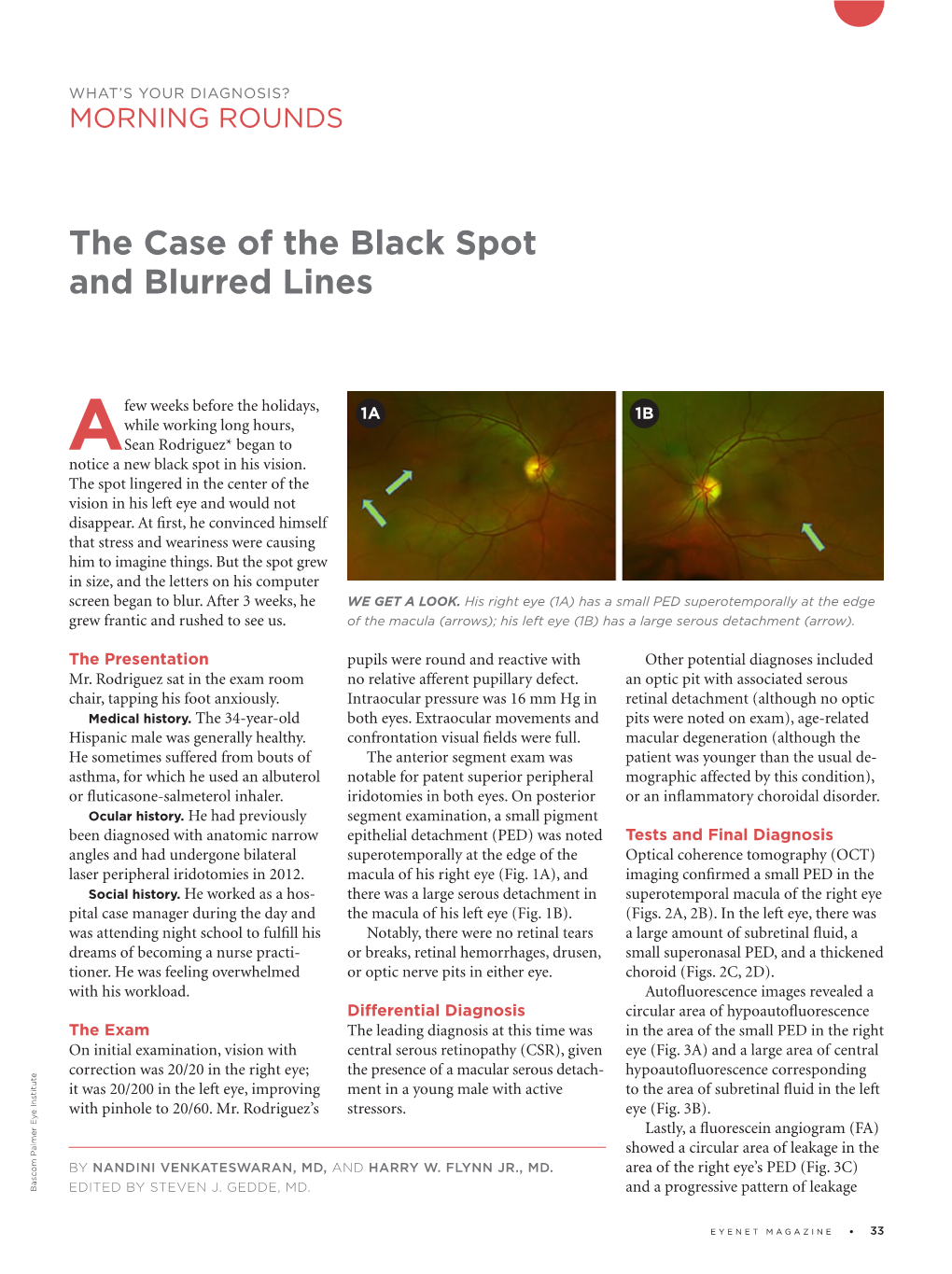 The Case of the Black Spot and Blurred Lines