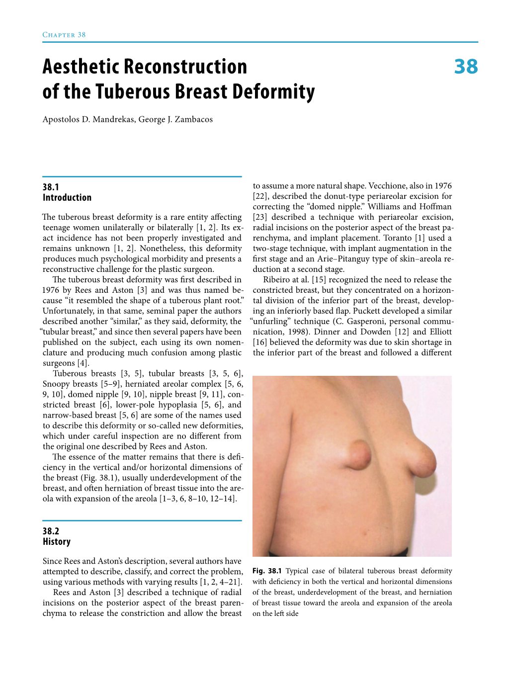 38 Aesthetic Reconstruction of the Tuberous Breast Deformity