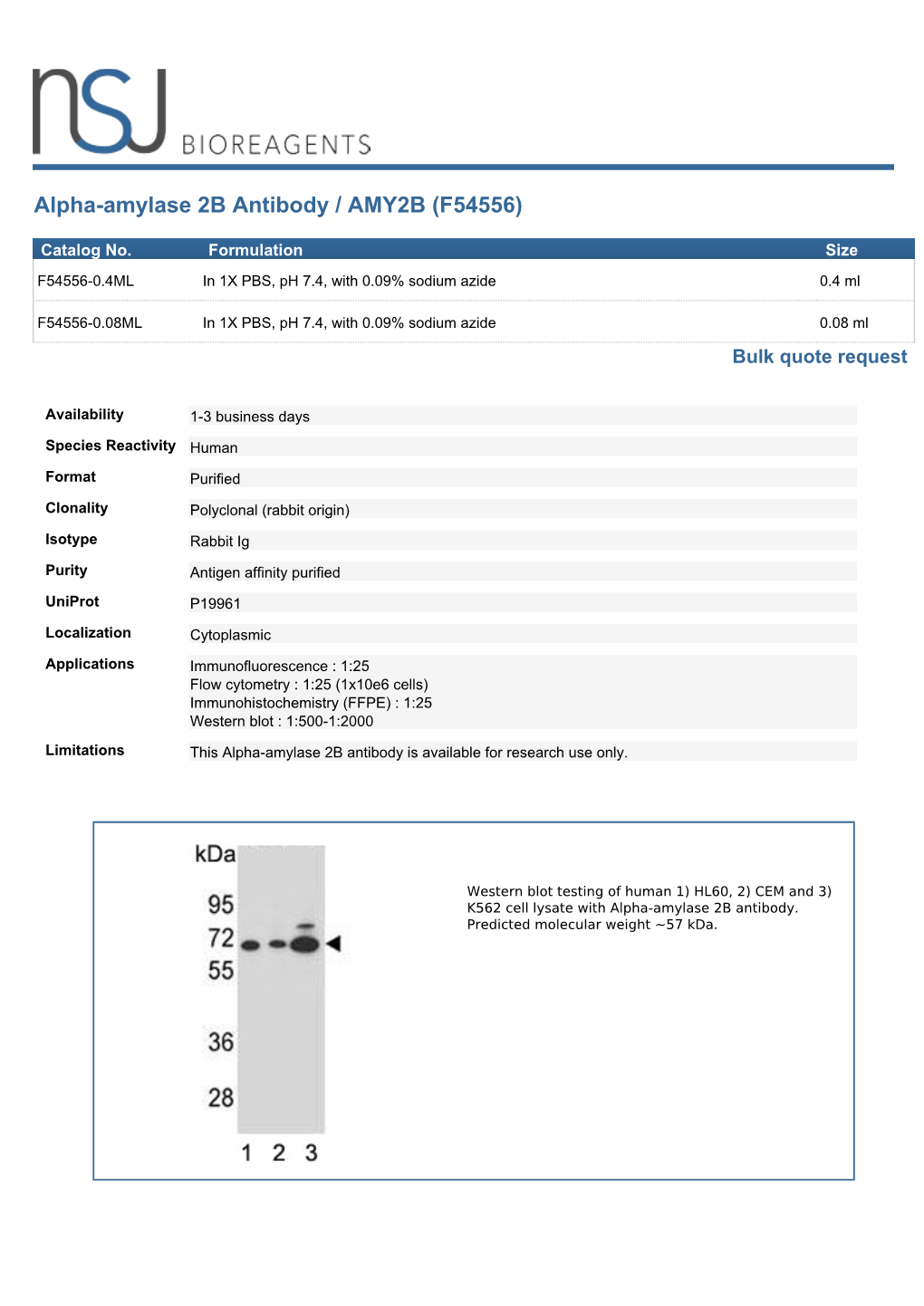 Alpha-Amylase 2B Antibody / AMY2B (F54556)