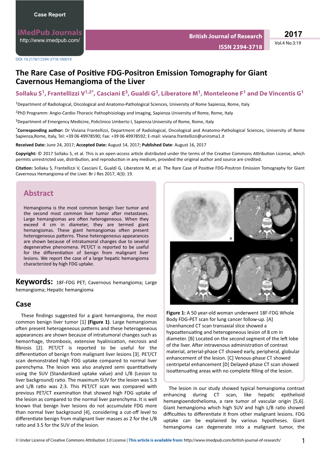 The Rare Case of Positive FDG-Positron Emission