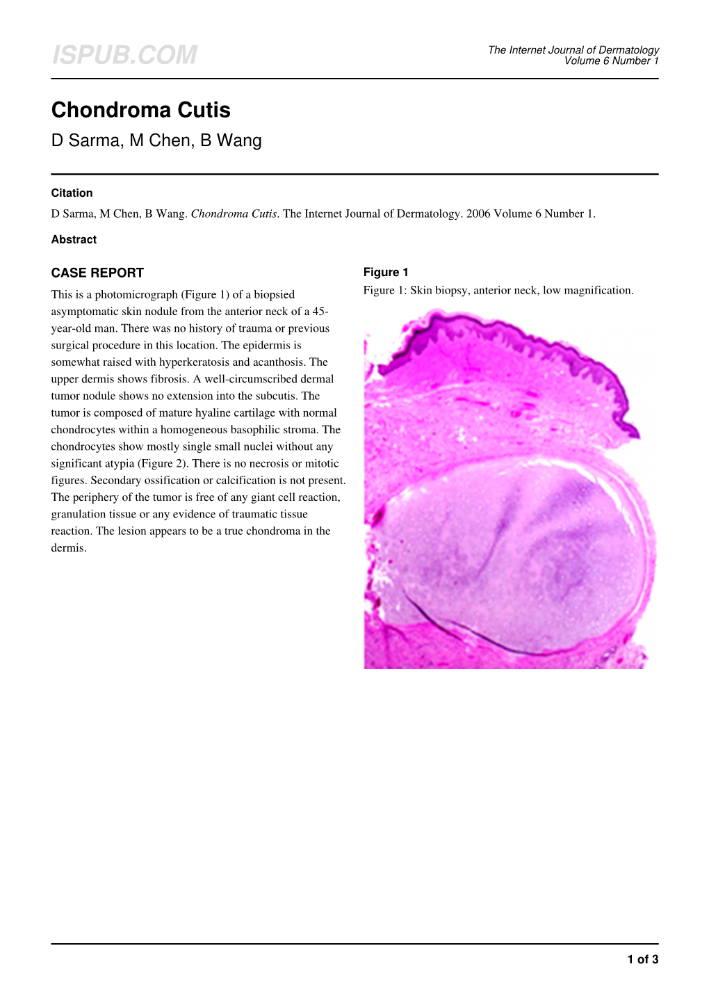 Chondroma Cutis D Sarma, M Chen, B Wang