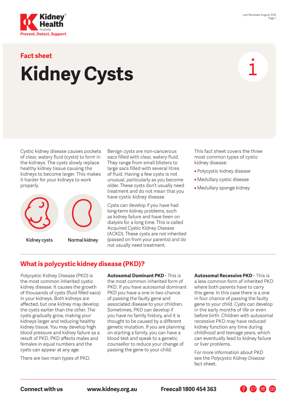 Kidney Cysts Fact Sheet