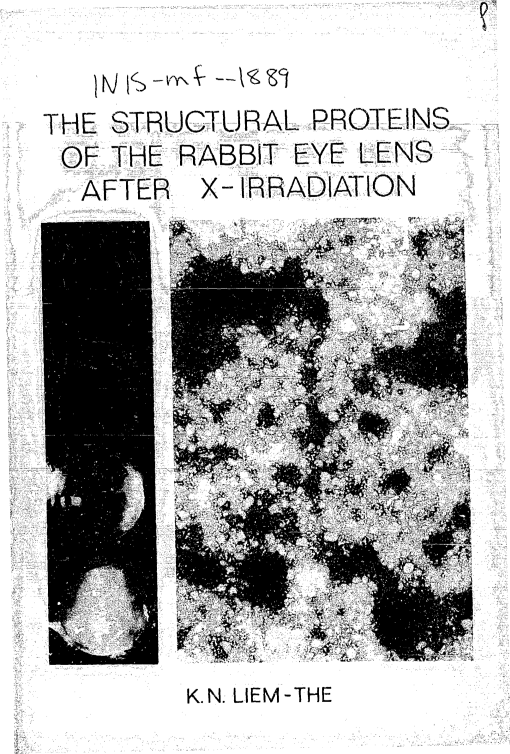 The Structural Proteins of the Rabbit Eye Lens After X-Irradiation