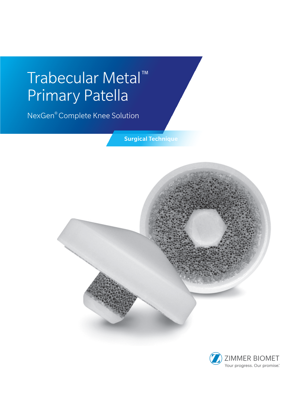 Trabecular Metal™ Primary Patella Nexgen® Complete Knee Solution